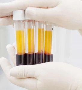 Plasma-Rico-en-Plaquetas-en-Medellín 4 - Clínica Estética en Medellín